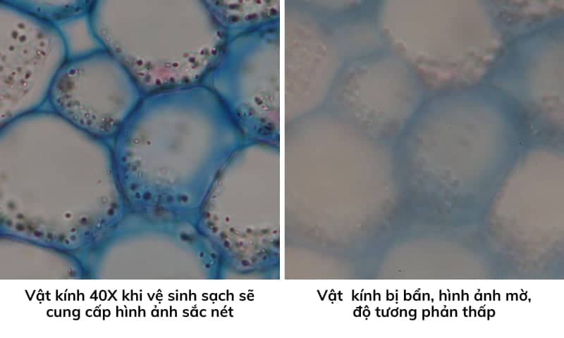 ve-sinh-kinh-hien-vi